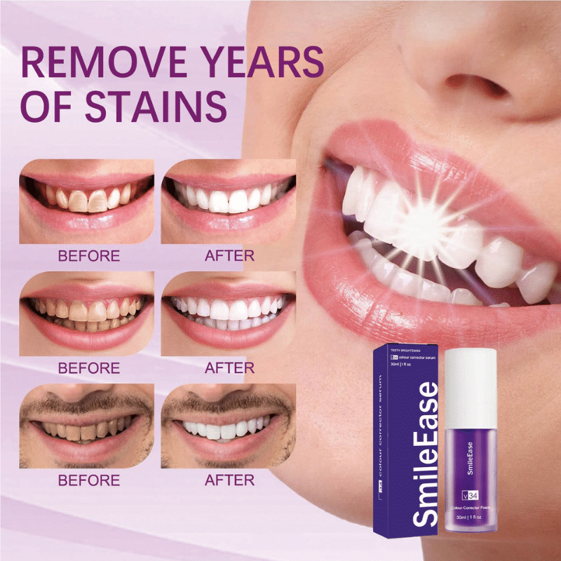 Hismile V34 Colour Corrector Toothpaste - Image 5